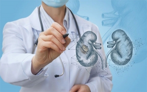 Covid-19 tiene afectados a pacientes con insuficiencia renal: Asocolnef